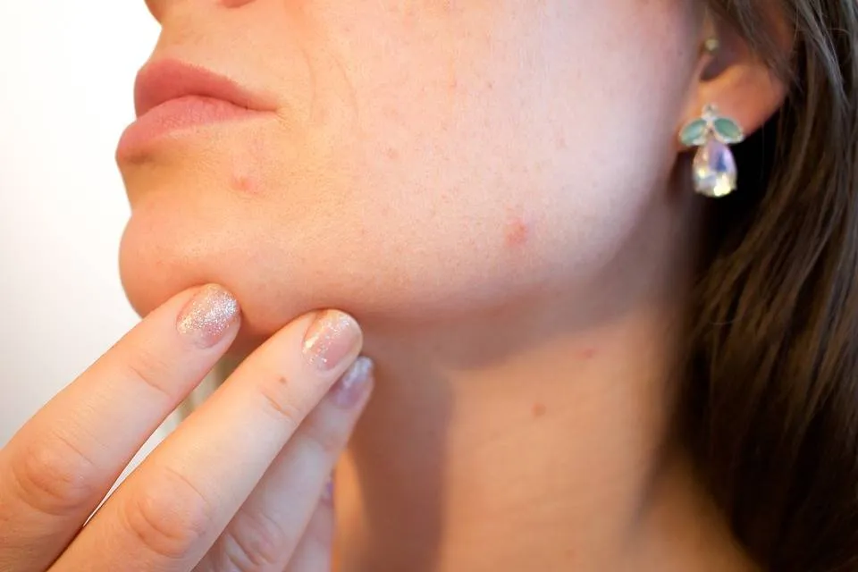 Da nhạy cảm là gì? Những "phản ứng thái quá" và nguyên nhân