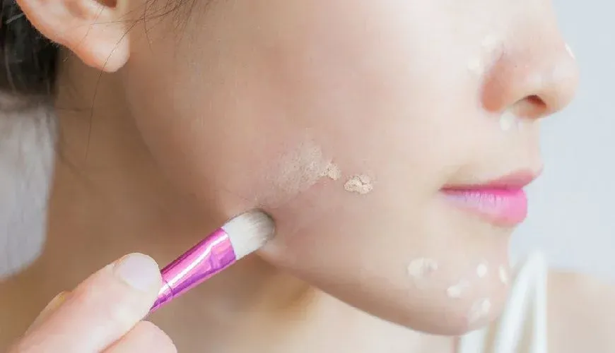Lưu ý chung khi trang điểm cho da mụn