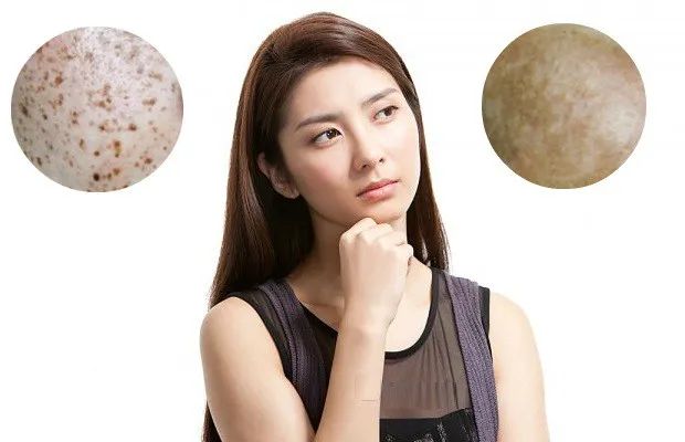 Làn da trong thai kỳ - Những thay đổi đặc biệt cần lưu ý